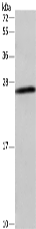 Rabbit Polyclonal Antibody to DCTN6