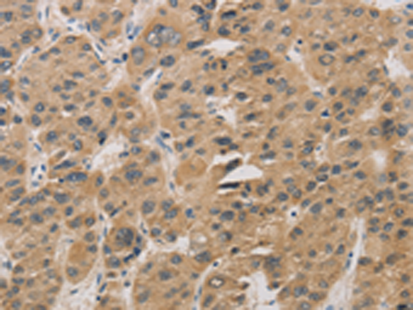 Rabbit Polyclonal Antibody to DDIT4