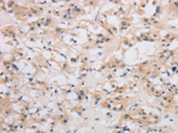 Rabbit Polyclonal Antibody to DDIT4L