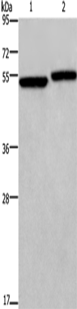 Rabbit Polyclonal Antibody to DDX19B