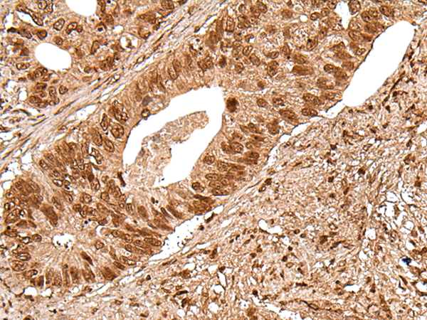 Rabbit Polyclonal Antibody to DEDD2