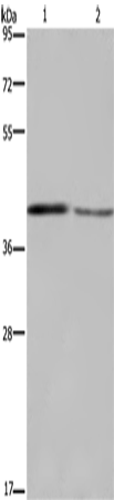 Rabbit Polyclonal Antibody to DEGS1