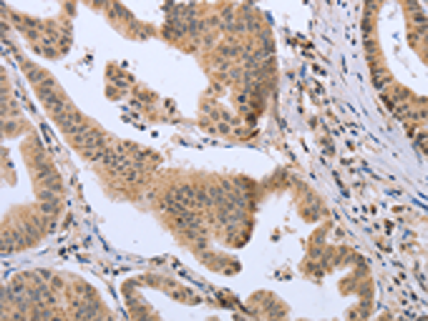 Rabbit Polyclonal Antibody to DLD