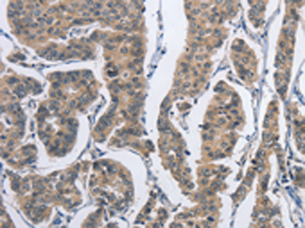 Rabbit Polyclonal Antibody to DSG2
