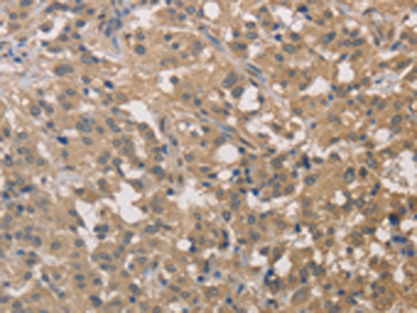 Rabbit Polyclonal Antibody to DSTN