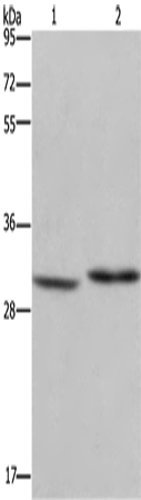 Rabbit Polyclonal Antibody to DHRS3