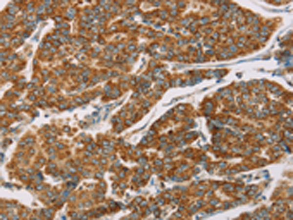 Rabbit Polyclonal Antibody to DLL4