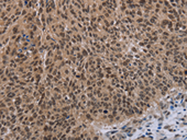 Rabbit Polyclonal Antibody to DLX4