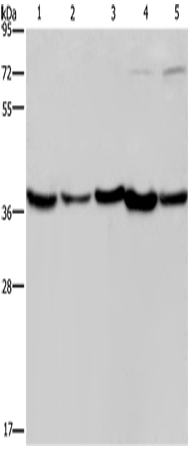 Rabbit Polyclonal Antibody to DNAJB4