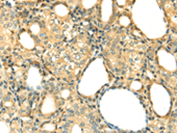 Rabbit Polyclonal Antibody to DNASE1