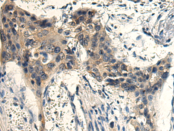Rabbit Polyclonal Antibody to DNM1L