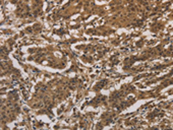 Rabbit Polyclonal Antibody to DUSP23