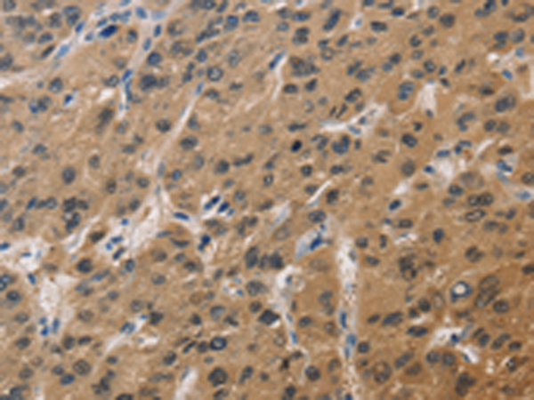 Rabbit Polyclonal Antibody to DUSP26