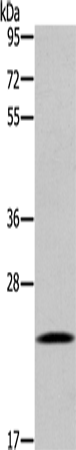 Rabbit Polyclonal Antibody to UBE2S