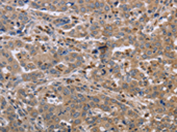 Rabbit Polyclonal Antibody to EDA