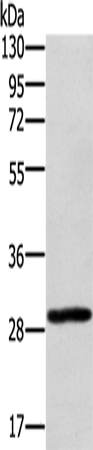 Rabbit Polyclonal Antibody to EDA2R