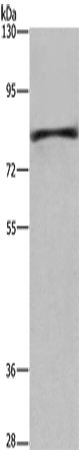 Rabbit Polyclonal Antibody to EHHADH