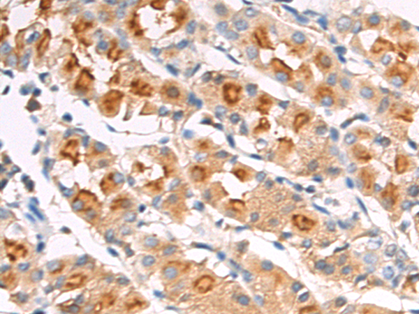 Rabbit Polyclonal Antibody to EIF3H