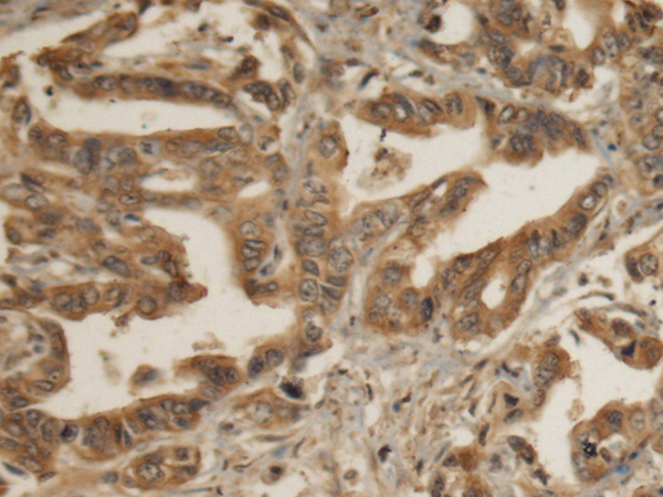 Rabbit Polyclonal Antibody to EIF4B
