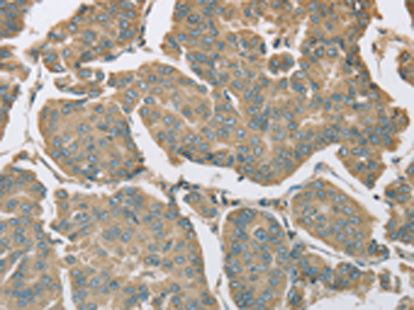 Rabbit Polyclonal Antibody to EIF5