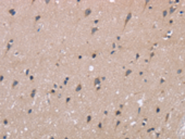 Rabbit Polyclonal Antibody to KIAA1324