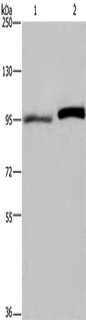 Rabbit Polyclonal Antibody to ELAC2