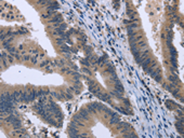 Rabbit Polyclonal Antibody to KCNJ11