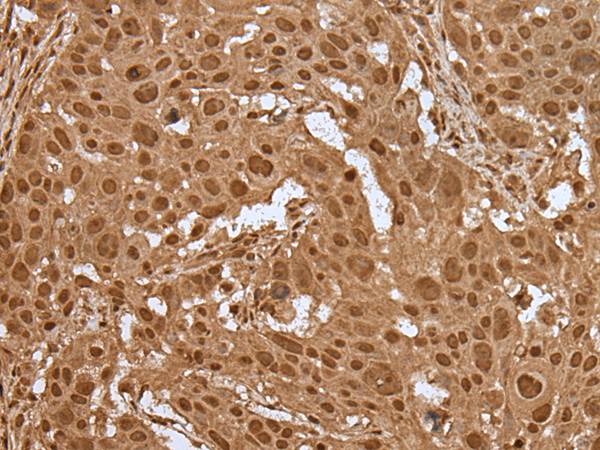 Rabbit Polyclonal Antibody to ELF1