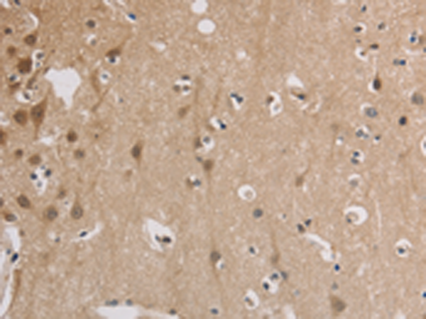 Rabbit Polyclonal Antibody to ELOVL1
