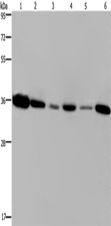 Rabbit Polyclonal Antibody to EMD