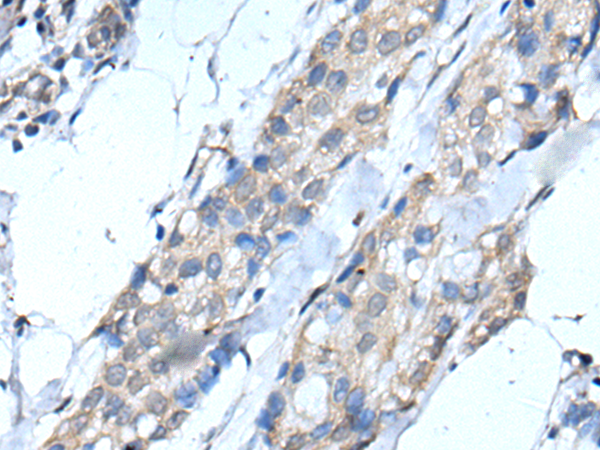 Rabbit Polyclonal Antibody to SCNN1G