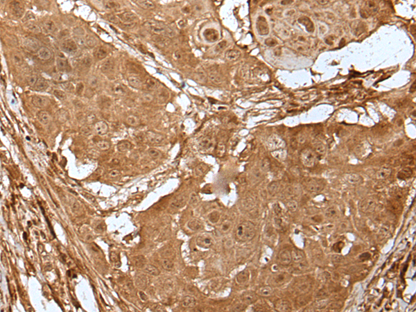 Rabbit Polyclonal Antibody to LIPG