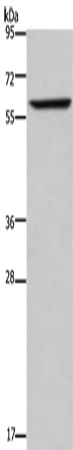 Rabbit Polyclonal Antibody to ENTPD5