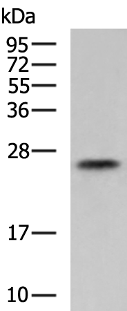 Rabbit Polyclonal Antibody to EPDR1
