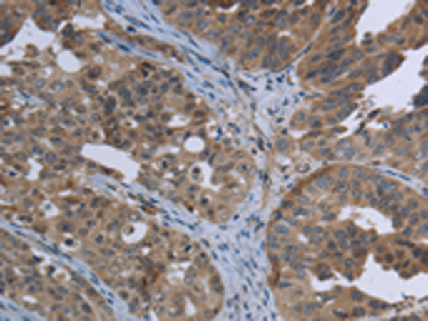 Rabbit Polyclonal Antibody to EPHA10