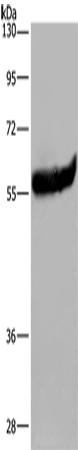 Rabbit Polyclonal Antibody to ESR2