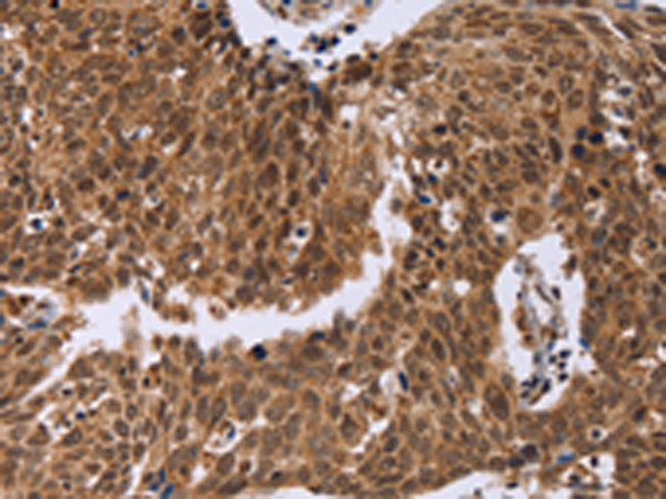 Rabbit Polyclonal Antibody to ERCC6L