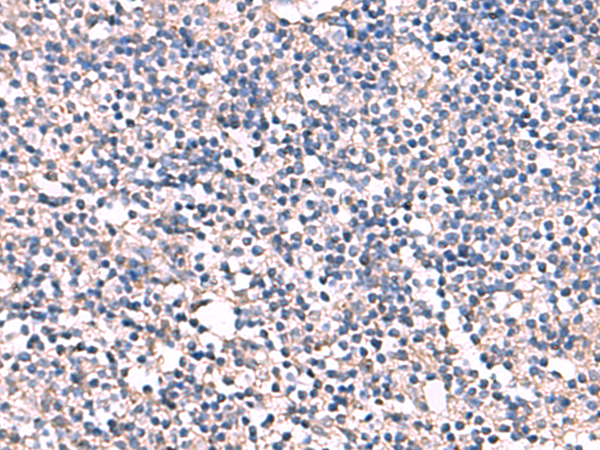 Rabbit Polyclonal Antibody to ESM1