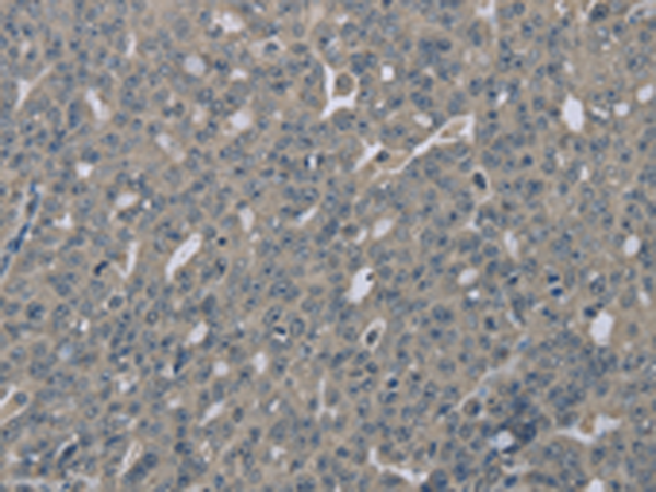 Rabbit Polyclonal Antibody to EDN1
