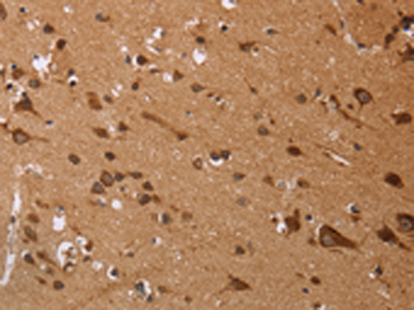 Rabbit Polyclonal Antibody to EDN3