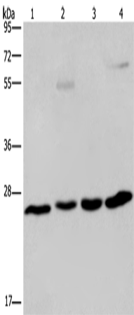 Rabbit Polyclonal Antibody to ETHE1