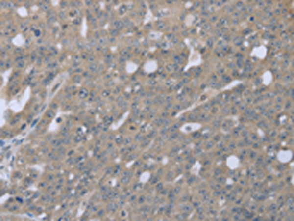 Rabbit Polyclonal Antibody to BMX