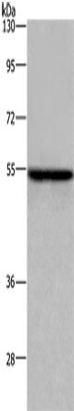 Rabbit Polyclonal Antibody to ETS2