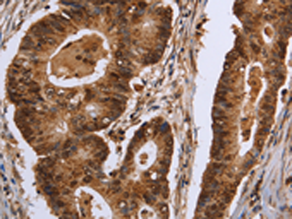 Rabbit Polyclonal Antibody to EXTL3