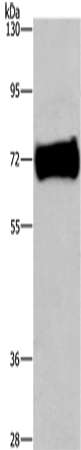 Rabbit Polyclonal Antibody to EZR