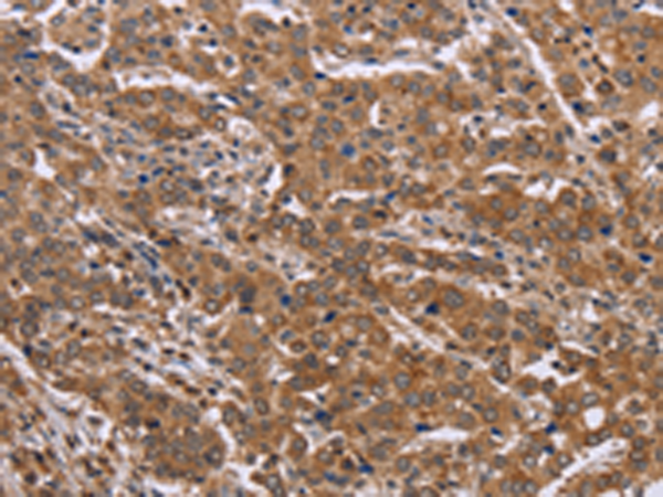 Rabbit Polyclonal Antibody to FAAH2