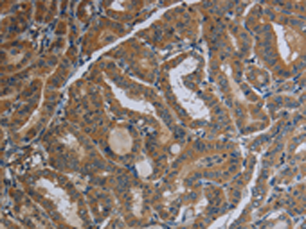Rabbit Polyclonal Antibody to FAAH