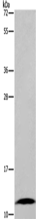 Rabbit Polyclonal Antibody to FABP6