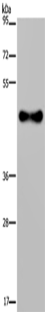Rabbit Polyclonal Antibody to FADS1