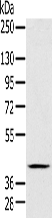 Rabbit Polyclonal Antibody to FCMR